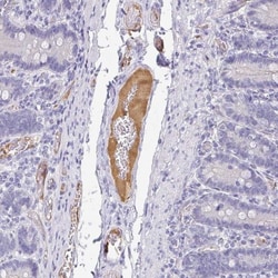 Apolipoprotein B/ApoB Antibody, Novus Biologicals 0.1mL; Unlabeled:Antibodies,
